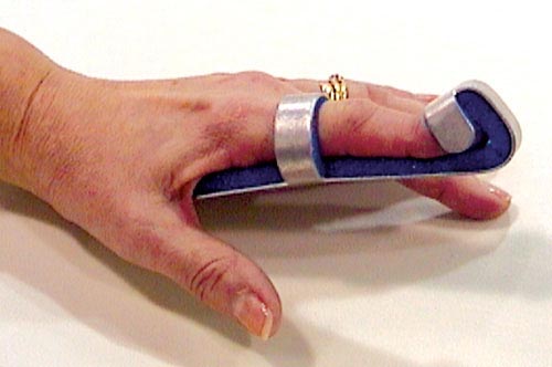 Baseball Finger Splint Medium Bulk  PK/6 Non-Retail