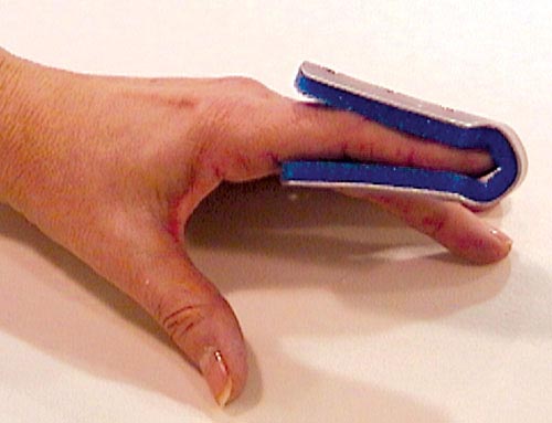 Fold Over Finger Splint Large Bulk  PK/6 Non-Retail